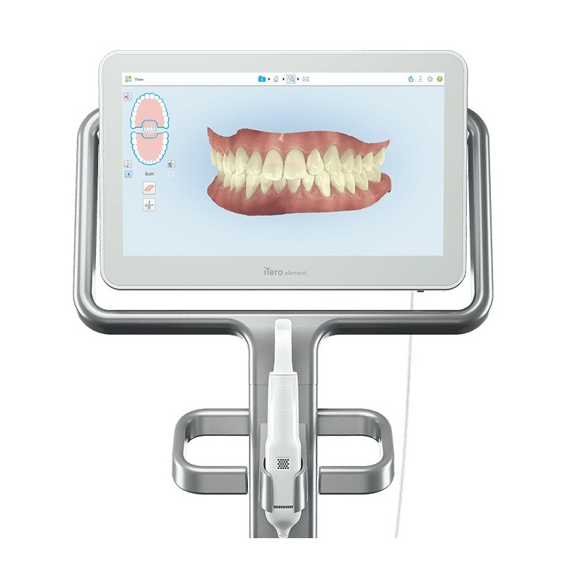 ITERO scanner Ortodonzia digitale