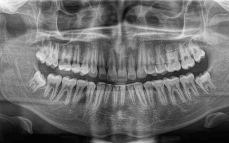 moduli ortodonzia digitale