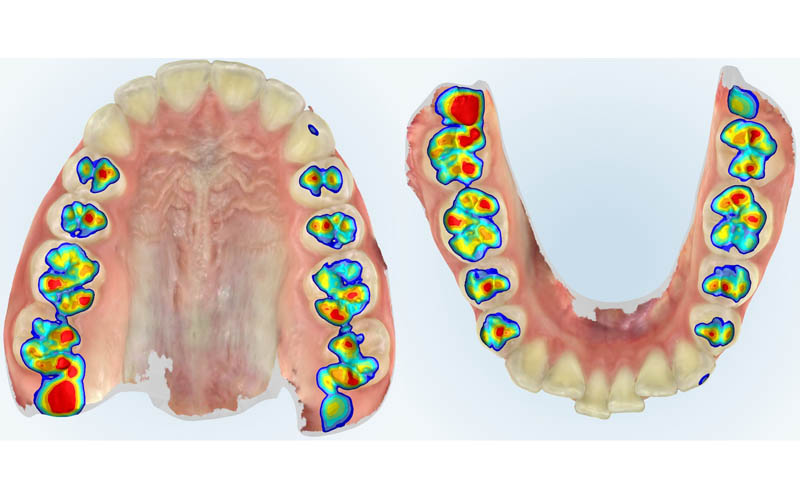 impronta denti digitale